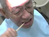 割り箸を噛んで頂きました：入れ歯の動画2