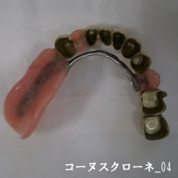 コーヌスクローネ02