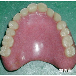 総義歯01