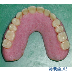 総義歯02