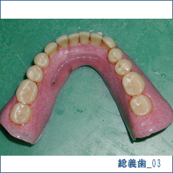 総義歯03