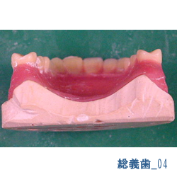 総義歯04