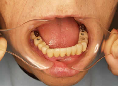 �C���v�����g�̉摜